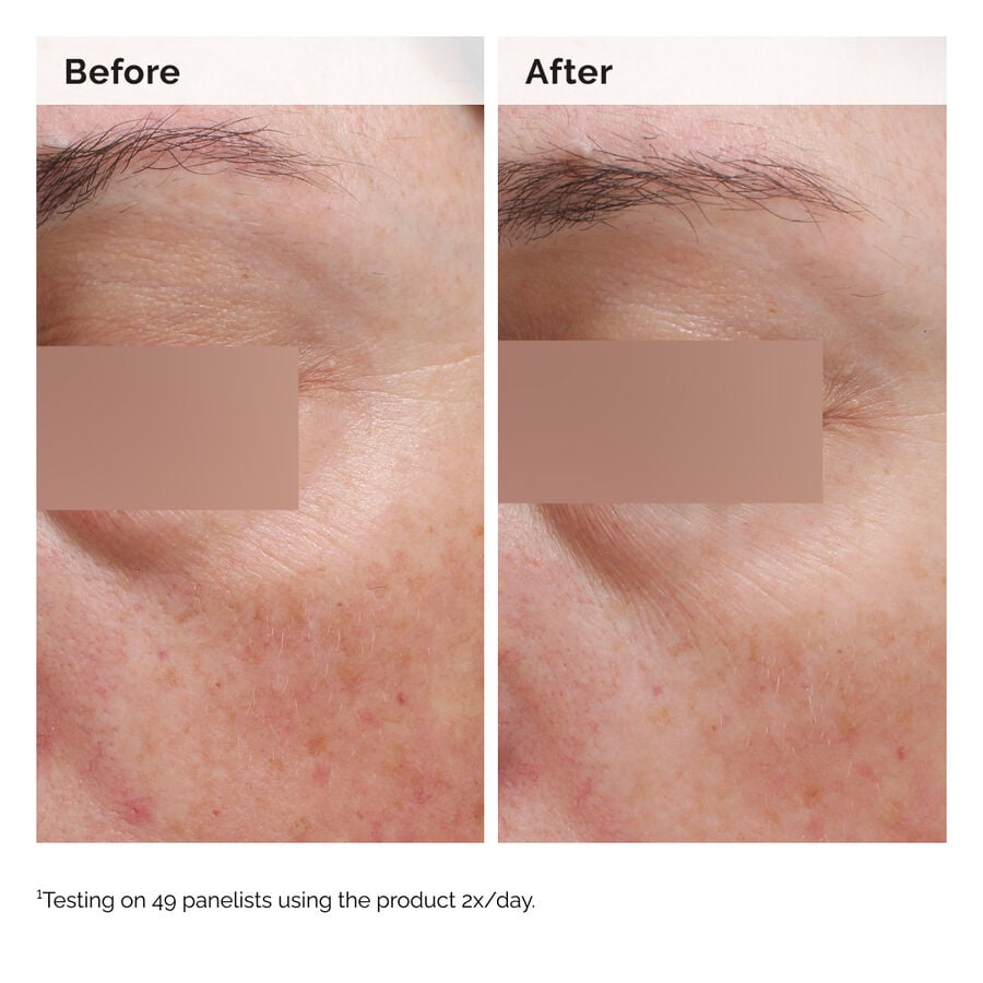 niacinamide-5-face-and-body-emulsion-t9 2024-08-23-ORD-Nia-5pct-Face-Body-B-A-Elasticity-Global-02-1x1.jpg