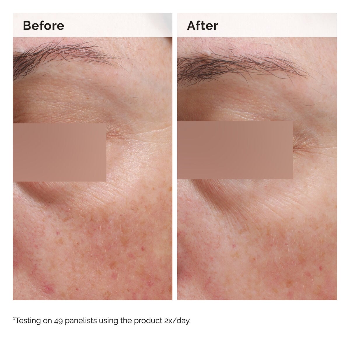 niacinamide-5-face-and-body-emulsion-t9 2024-08-23-ORD-Nia-5pct-Face-Body-B-A-Elasticity-Global-02-1x1.jpg