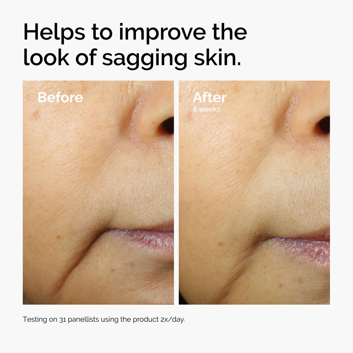 caffeine-3-escin-1-face-serum-y9 ord-caffeine-3pct-escin-1pct-face-serum-before-after-sagging.jpg