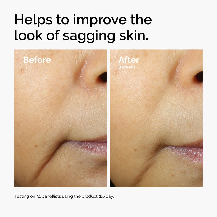 caffeine-3-escin-1-face-serum-y9 ord-caffeine-3pct-escin-1pct-face-serum-before-after-sagging.jpg
