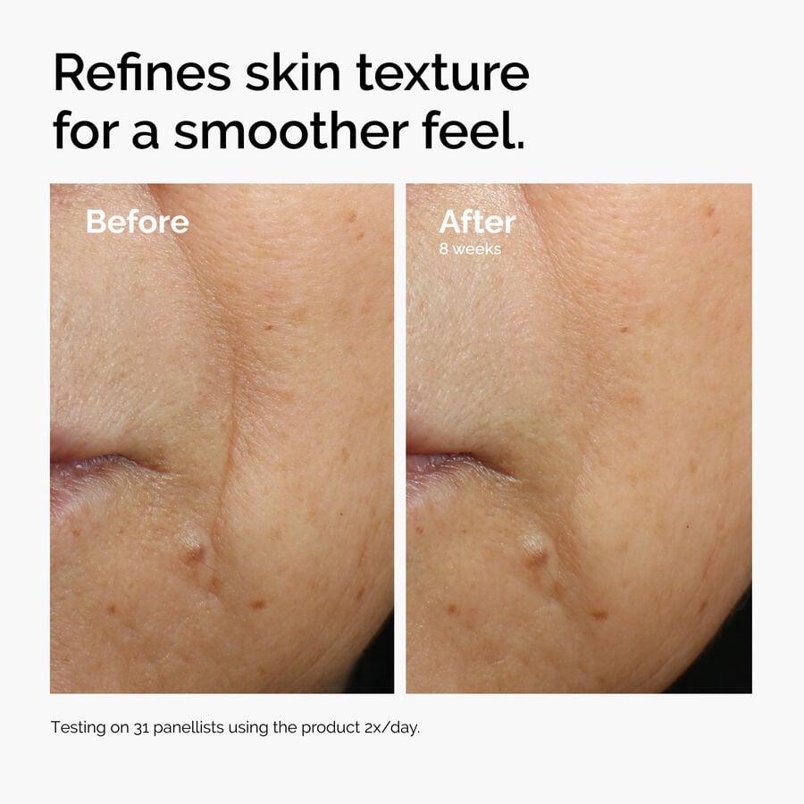 caffeine-3-escin-1-face-serum-y9 ord-caffeine-3pct-escin-1pct-face-serum-before-after-texture.jpg