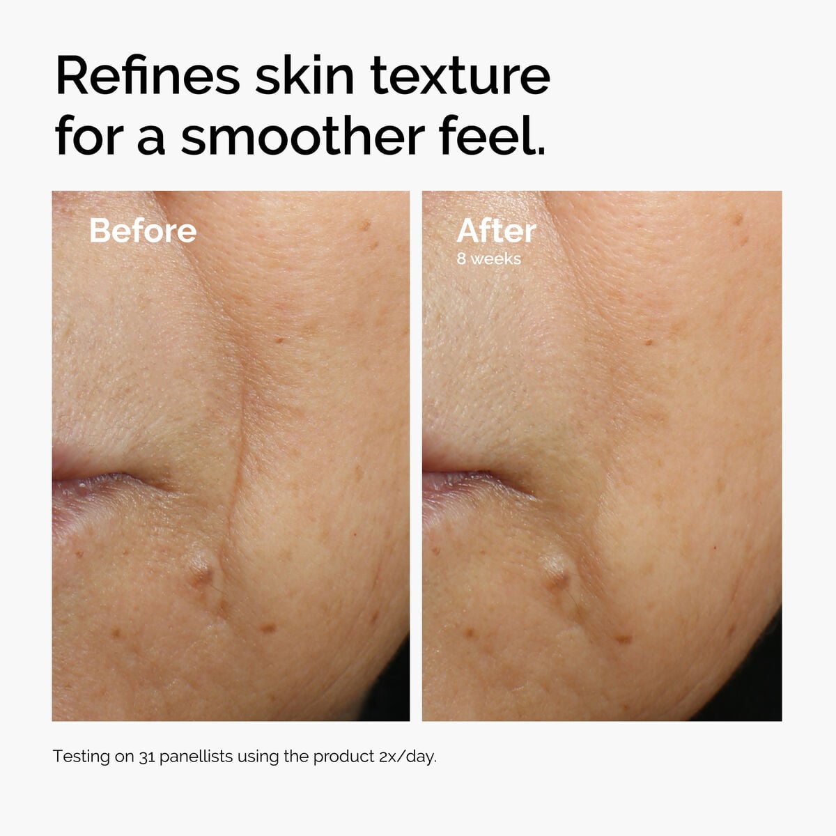 caffeine-3-escin-1-face-serum-y9 ord-caffeine-3pct-escin-1pct-face-serum-before-after-texture.jpg