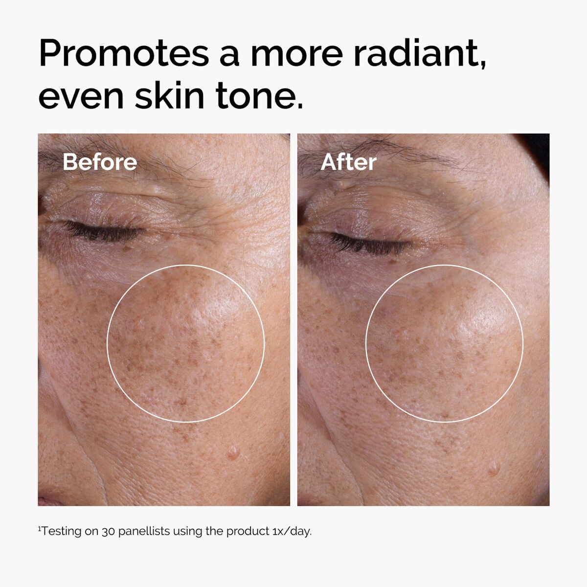glycolic-acid-7-exfoliating-toner-z6 ord-glycolic-before-after-radiance.jpg