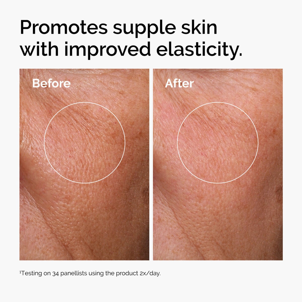 hyaluronic-acid-2-b5-with-ceramides-s8 ord-hyaluronic-acid-2pct-b5-hydrating-serum-before-after-elasticity.jpg