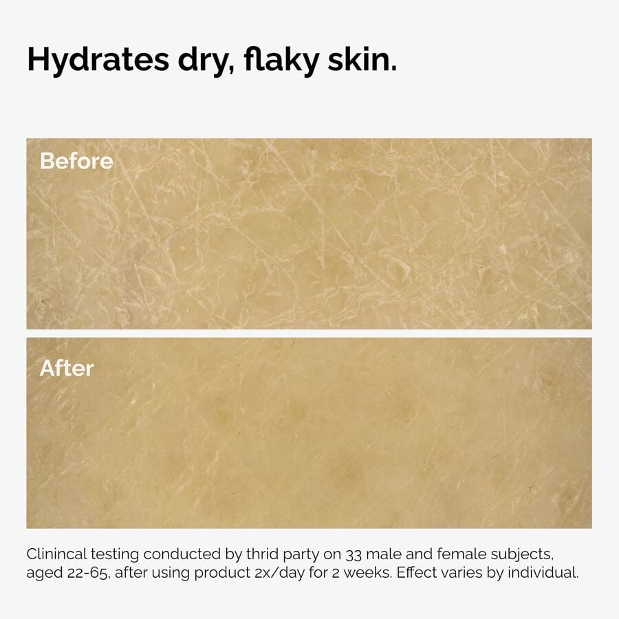 the-body-care-collection-z9 ord-natural-moisturizing-factors-inulin-body-before-after-graphic-02.jpg