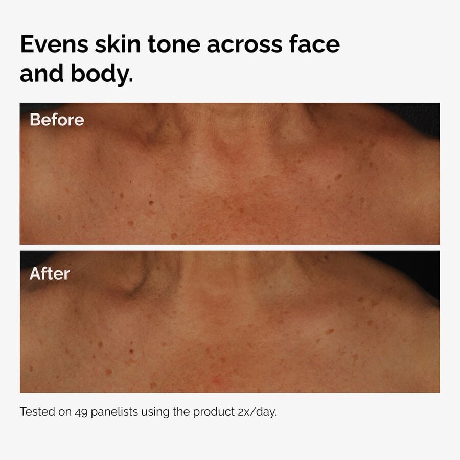 the-body-care-collection-z9 ord-niacinamide-face-body-serum-before-after-even-tone-graphic.jpg