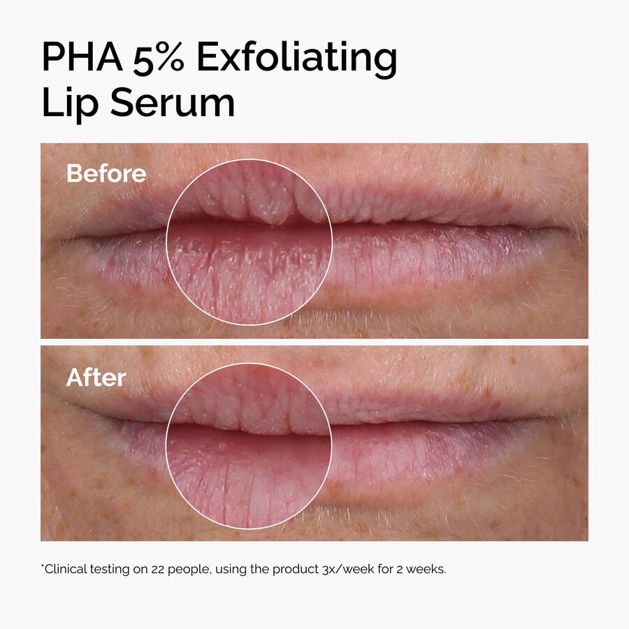 pha-5-exfoliating-lip-serum-h2 ord-pha-5pct-lip-exfoliating-serum-before-after.jpg