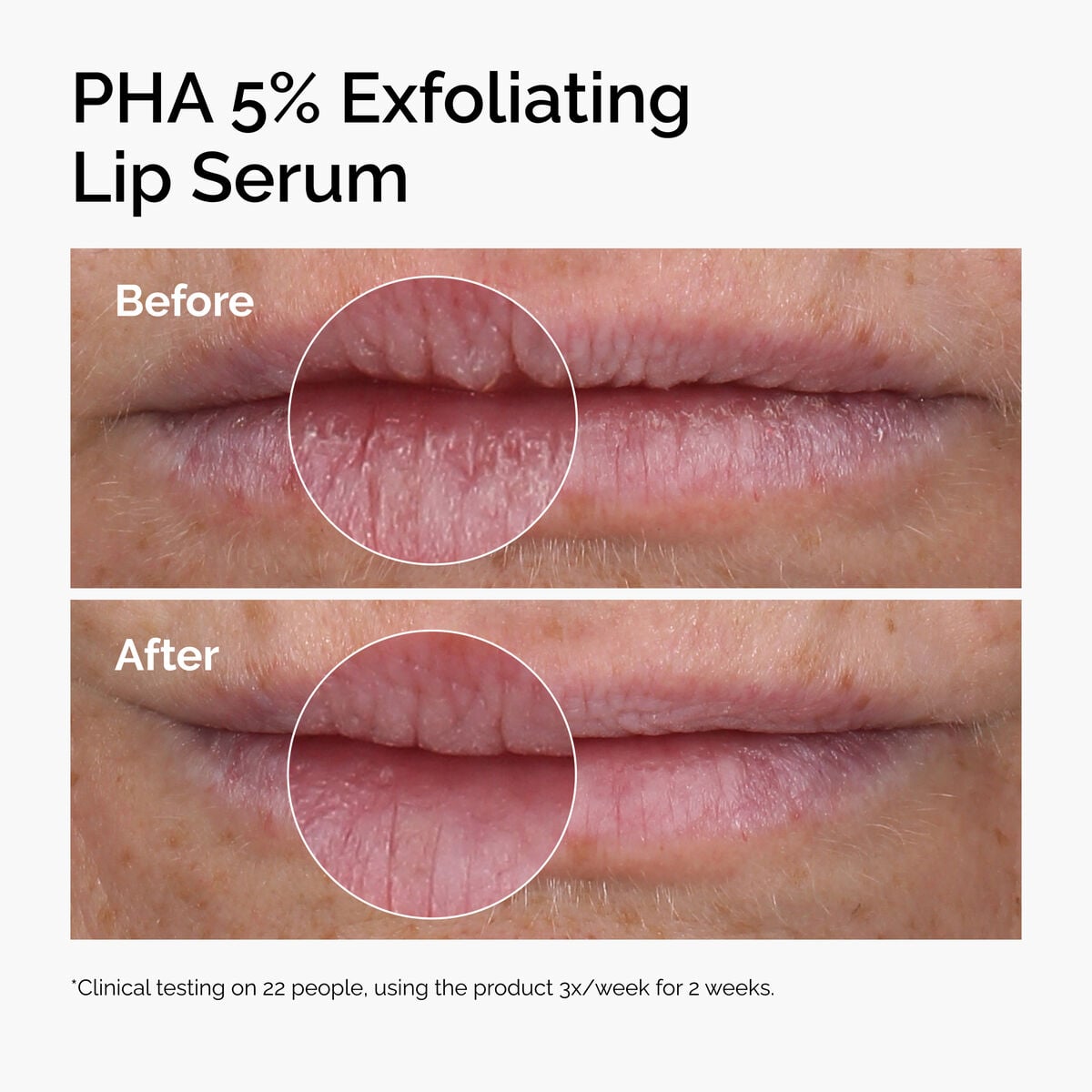 pha-5-exfoliating-lip-serum-h2 ord-pha-5pct-lip-exfoliating-serum-before-after.jpg